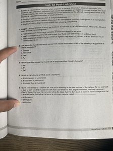 Lab 12 Post-Lab QuizBotulism is a disease that can occur when... | Filo