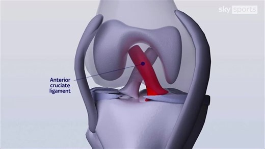 Future of Football: Why ACL injuries have been on rise in women's game - and the technology and solutions to fix it