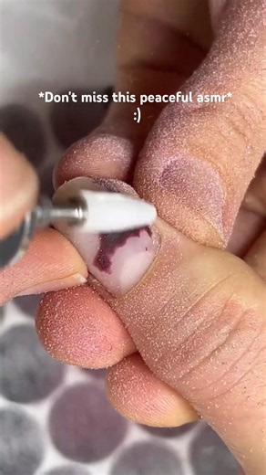 From Ugly to Gorgeous Nails! 😱💅 Satisfying ASMR
