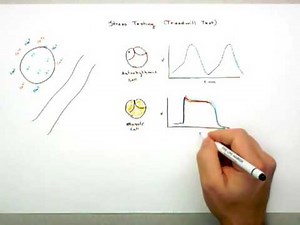 Stress Testing (Treadmill Test) Part 1