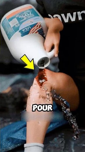 Why You Shouldn’t Put Alcohol on Cuts 😨