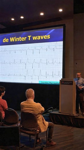 The most critical findings aren’t always the most obvious. 🫀⚡ A de Winter T wave is one of those sneaky ECG patterns that can signal a serious heart attack is starting, even when the tracing doesn’t show the classic changes we’re trained to look for. As Heart Month wraps up, it’s a great time to remember that catching these subtle clues early can make all the difference. 👉 Join CAEP and get 25% off an annual plan of @ecgweekly with Dr. Amal Mattu . . . #emergencymedicine #ecg #ekg #electrocard
