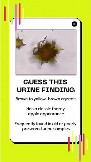 Guess this Urine Finding #2 | Urinalysis Review