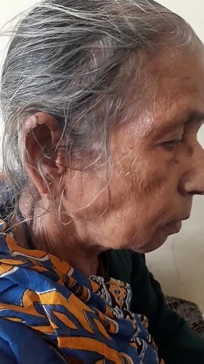 Head nodding of essential tremor