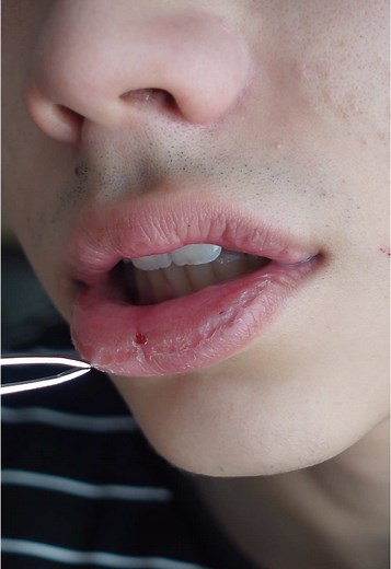 Tips for Beautiful Lips: Red Lipstick, Lip Care, and More!