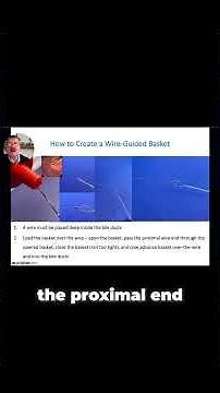 Key Techniques and Best Practices for a Gastrojejunostomy
