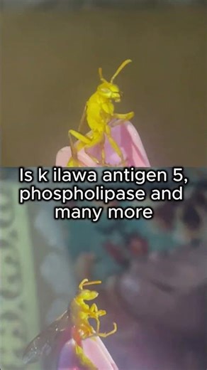 “You’ve NEVER Seen a Wasp This Close… 😬”