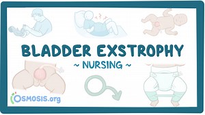 Bladder exstrophy: Nursing: Video & Causes | Osmosis