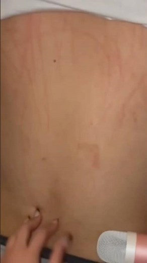 asmr back scratching #asmr #backscratchingasmr #couple