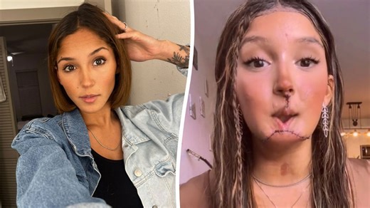 Suicide attempt survivor, 23, with gunshot wound becomes voice for mental illness