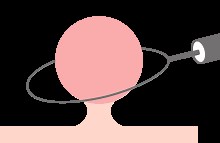 大腸カメラ検査