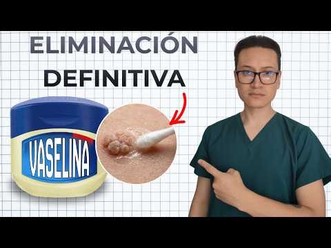 3 Safe Ways to Remove HPV Warts