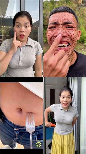 Too Many Pimples… Should You Pop Them? 😳😂