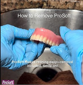 How to Remove ProSoft Denture Reliner Kit from Your Dentures
