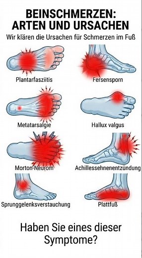 Fußschmerzen verstehen: 8 häufige Ursachen & Symptome im Überblick!