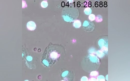 中性粒细胞NETosis死亡续集：DNA和蛋白网加强了其他免疫细胞的免疫反应