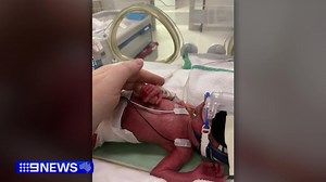 They're our smallest but strongest fighters, and Gold Coast University Hospital is now supporting babies in a new high dependency unit. #9News | 9 News Gold Coast