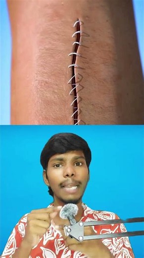🤯కుట్లు వేస్తే గాయం ఎలా మానిపోతుందో తెలుసా 😱#telugu #telugufacts #facts #mystery
