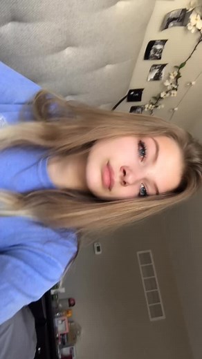 i got pink eye and it really hurts🤦🏼♀️🙄 #foryou