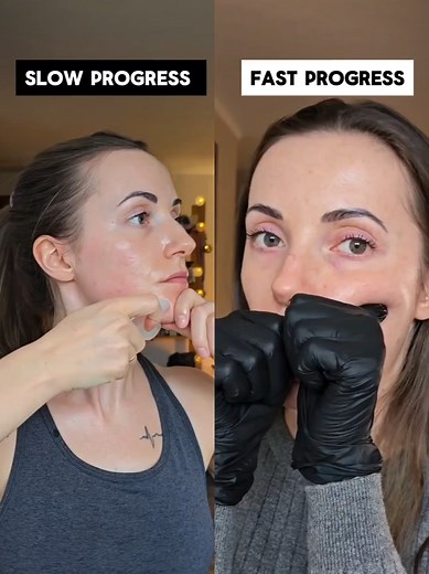 Essential Face Fitness Techniques for Youthful Skin