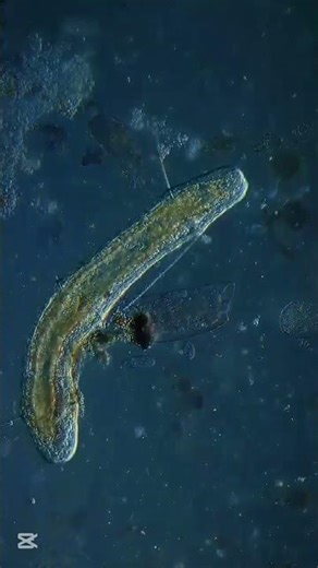 1. Dileptus. 2. Ciliates eating mosquito eggs. 3. Flatworm.