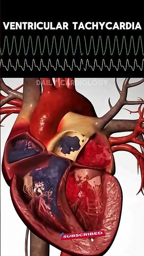 ECG rhythms with Heart Animation #nursing #heart #anatomy