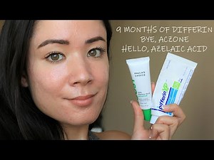 👧🏻 SKIN UPDATE [#2]: 9 Months of Differin, Before + Afters of Acne Scars | MICHXMASH