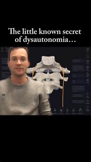 Atlas Spine and Wellness Care on Instagram: "Dizziness, unexplained anxiety, feeling of being "on" all the time, headaches, brain fog and many more symptoms are associated with dysautonomia. Dysautonomia is a broad umbrella term referring to the dysfunction of the autonomic nervous system. The autonomic nervous system controls all things you don't need to think about (heart rate, breathing, digestion, etc.) Dysautonomia is closely linked to the upper neck spine (particularly the Atlas (C1) verte