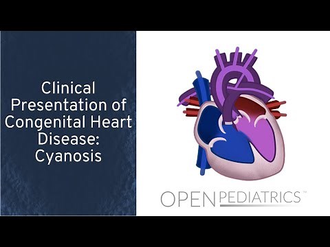 Cyanosis by M. Freed, I. Baiu, L. DelSignore | OPENPediatrics
