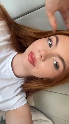 Double Jaw Surgery Recovery Journey: A Complete Timeline