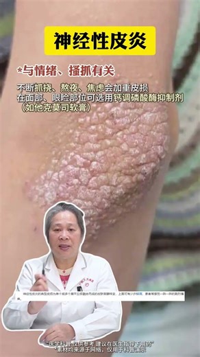 Common skin diseases on the body How do doctors teach you to deal with them#Skin#Dermatolo