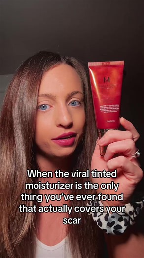 Perfect Cover BB Cream: A Must-Have for Scar Coverage