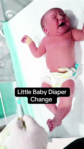 Cute Little Baby Diaper Change 🍼💗 | Sweet & Adorable Baby Moments#CuteBaby #DiaperChange