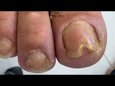 What we're about to see here is very strange.