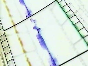 Eraser NBC WOC 2000 11 11