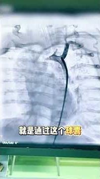 Baby's BP Skyrocketing at 150mmHg! What's Behind the High Blood Pressure