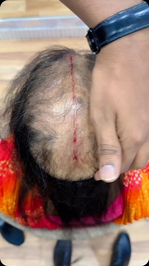 Nisha Lamba on Instagram: "Hair treatment 9718000940"