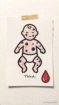 Rubella (German Measles)