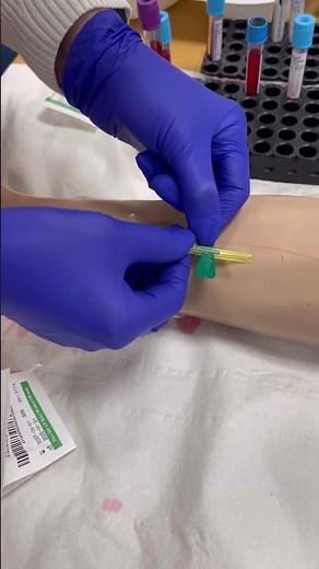 Locking SafetyLok Needle #vacutainer safety #locking #technique #prevention #needlestickinjury #risk