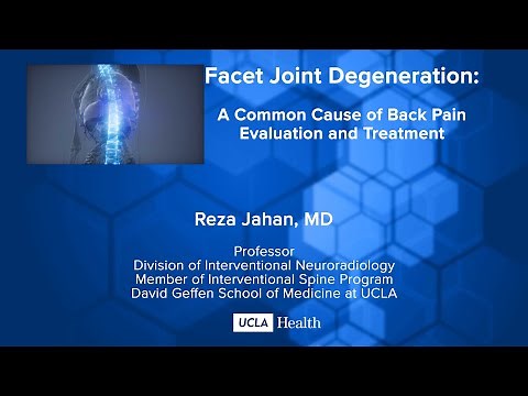 Facet Joint Degeneration: A Common Cause of Back Pain Evaluation and Treatment