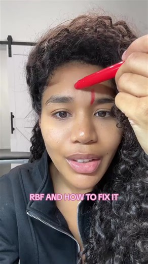 RBF and how to fix it👀 #rbf #botox #botoxnatural #aestheticinjector