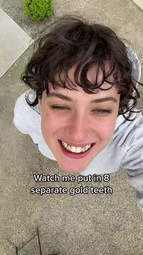 Putting in 8 Separate Gold Teeth: A Step-by-Step Guide