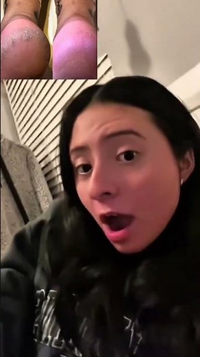 HOW to REMOVE DEAD SKIN from FEET FAST! 🦶 Best Satisfying Cracked Heels Removal At-HOME Foot Remedy!