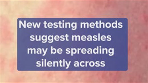 New testing suggests measles is silently spreading