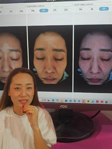 ¡Muchísimas personas están reservando su análisis facial! Pero quiero que sepan algo importante Nuestro análisis facial no es solo una revisión con máquina. Es un espacio para hablar de tu rutina, tus preocupaciones reales de piel y resolver todas tus dudas con calma Por eso, a cada persona le dedicamos mínimo 30 minutos o más. Debido a esto, no podemos atender a muchas personas al día, y las citas se están programando cada vez más adelante… de verdad, les pido disculpas por la espera Pero en es