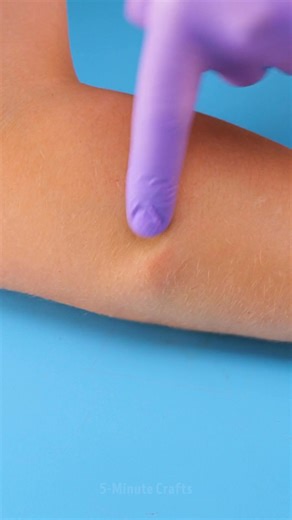 Got a Lump in Your Hand? | 5-Minute Crafts