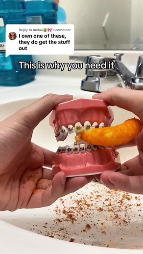 The Importance of Oral Hygiene: Water Flosser Benefits Explained