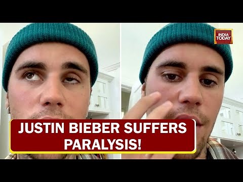Justin Bieber Suffers Face Paralysis: Singer Asks Fans To Be Patient | Ramsay Hunt Syndrome
