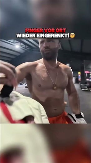 Broken finger while grilling?!😳 RINGLIFE