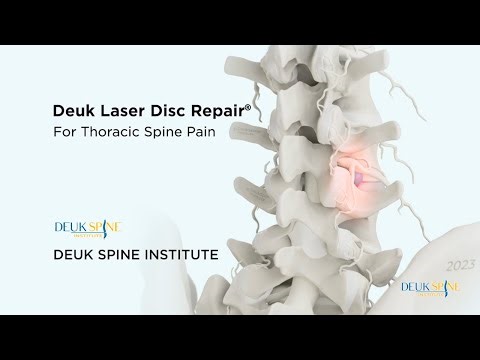 How to CURE Thoracic Back Pain with the Deuk Laser Disc Repair®
